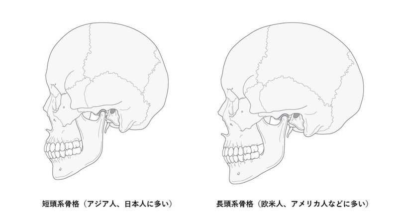 アジア人、欧米人、頭の形.